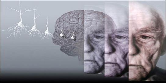 Nuovo Rapporto Mondiale sull'Alzheimer 2015