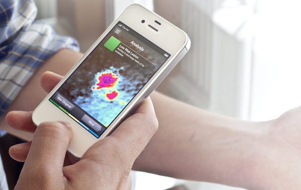 UN'APP PER DIAGNOSTICARE IL MELANOMA