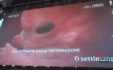 Aborto: Pro Vita & Famiglia, maxi proiezione in piazza a Roma di 'Baby Olivia'